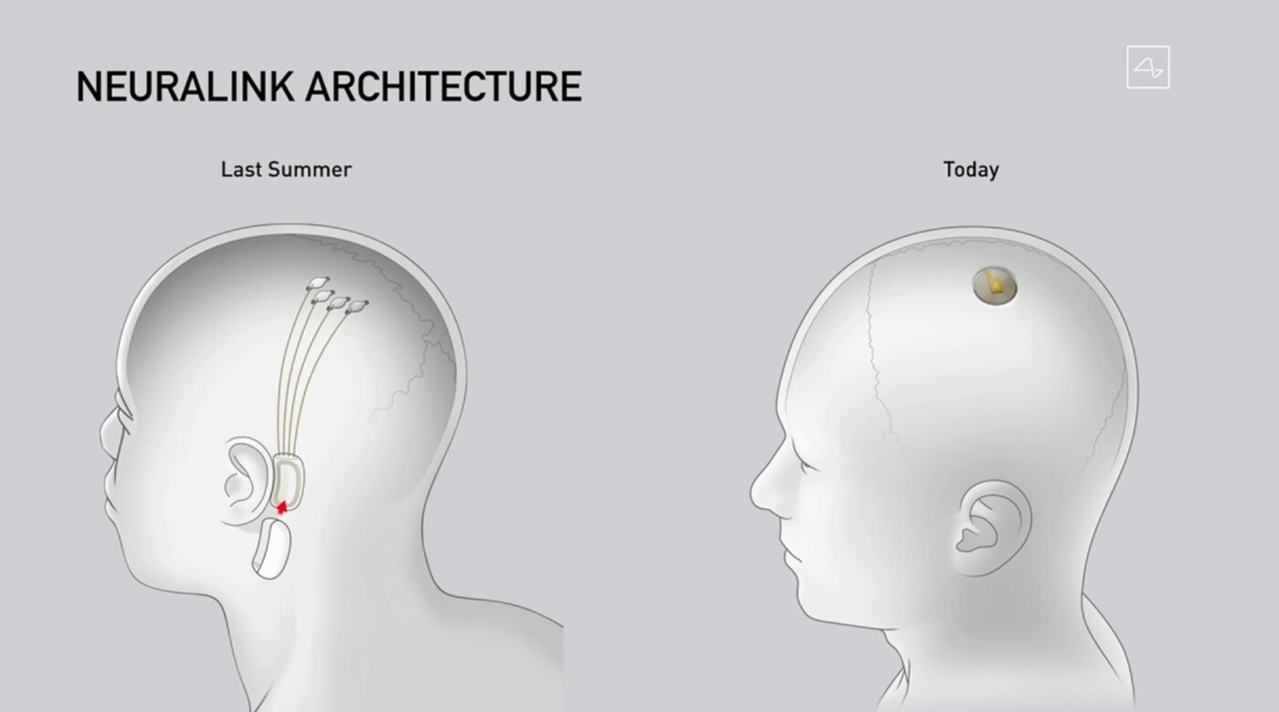 neuralink